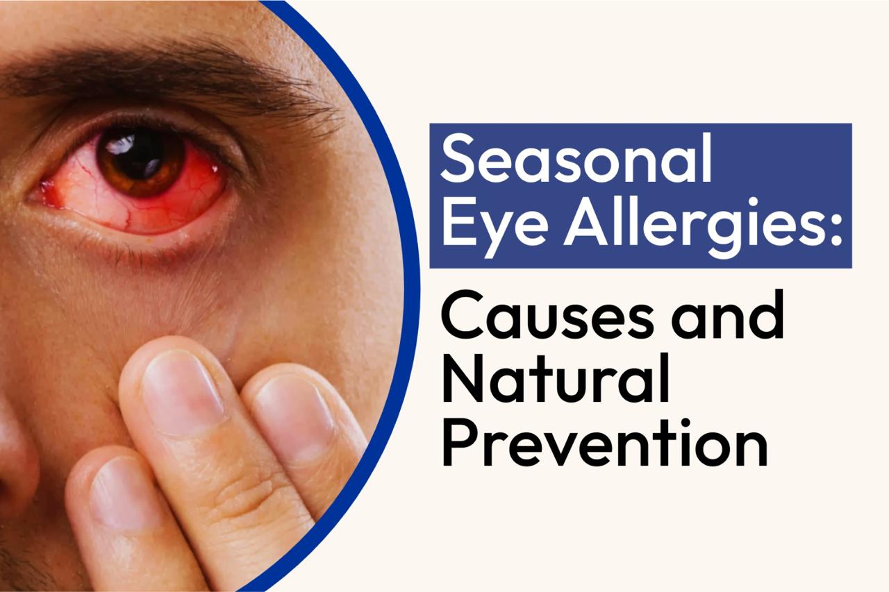 Seasonal Eye Allergies: Causes and Natural Prevention