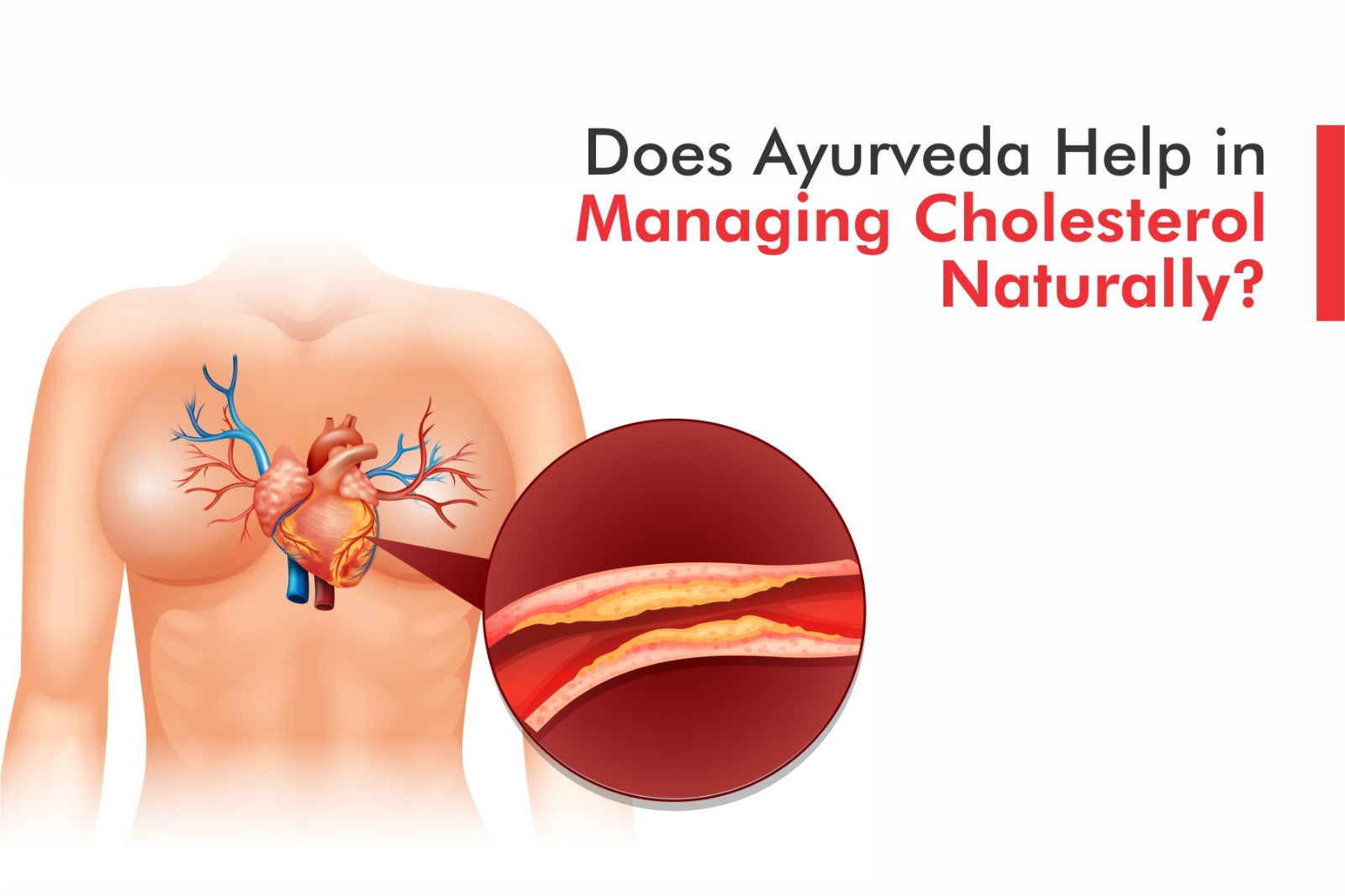 Does Ayurveda Help in Managing Cholesterol Naturally?
