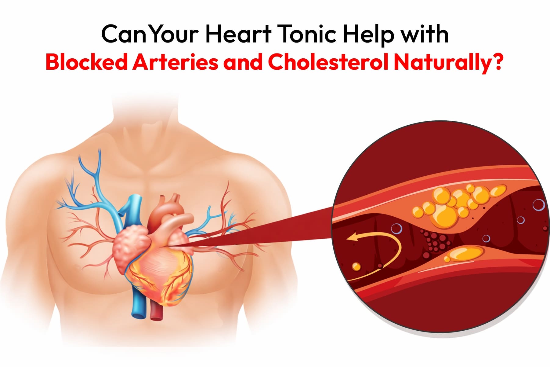 Can Your Heart Tonic Help with Blocked Arteries and Cholesterol Naturally?