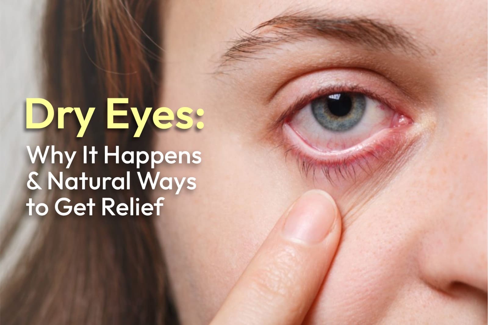 Dry Eyes: Why It Happens and Natural Ways to Get Relief