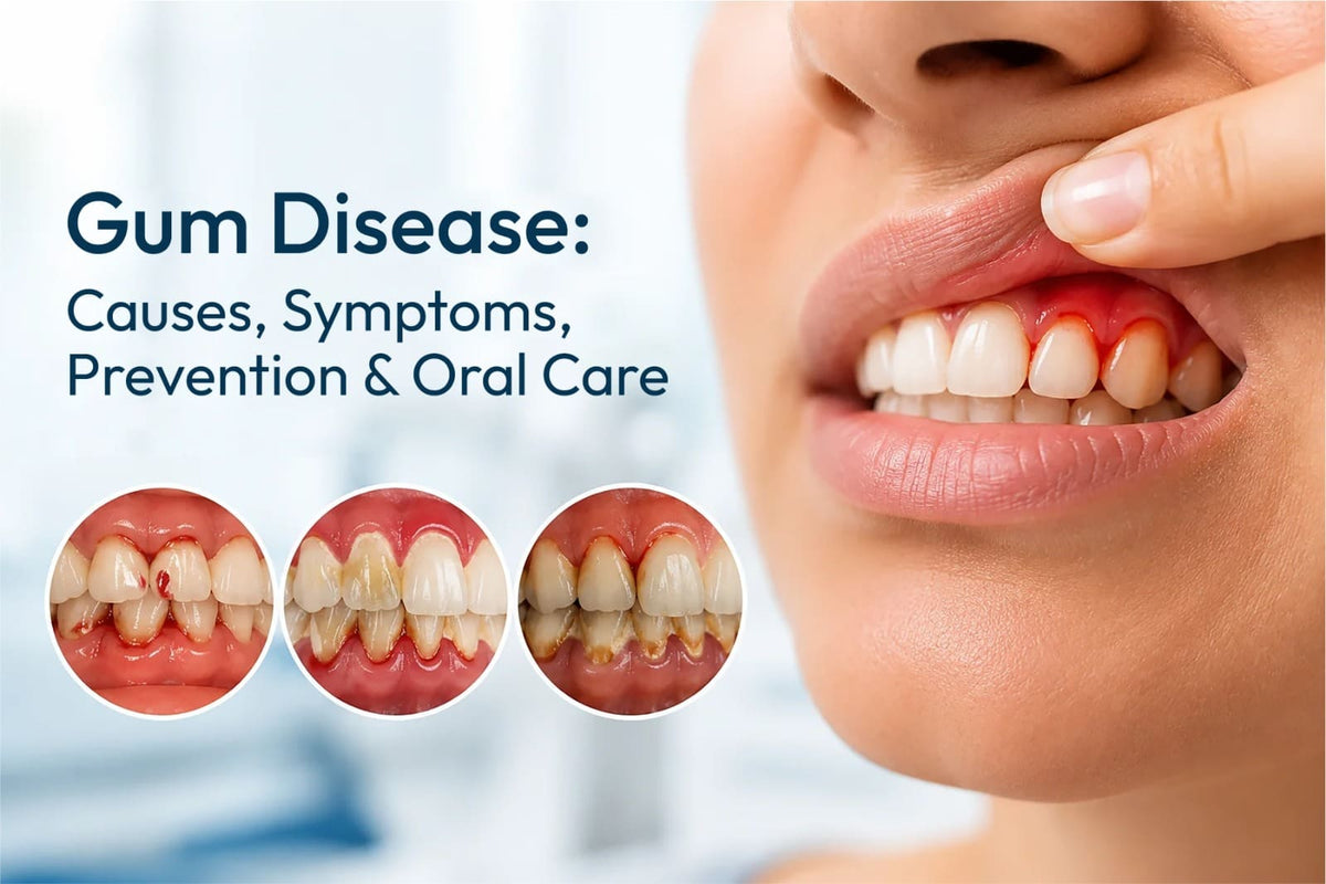 Gum Disease: Causes, Symptoms, Prevention & Oral Care