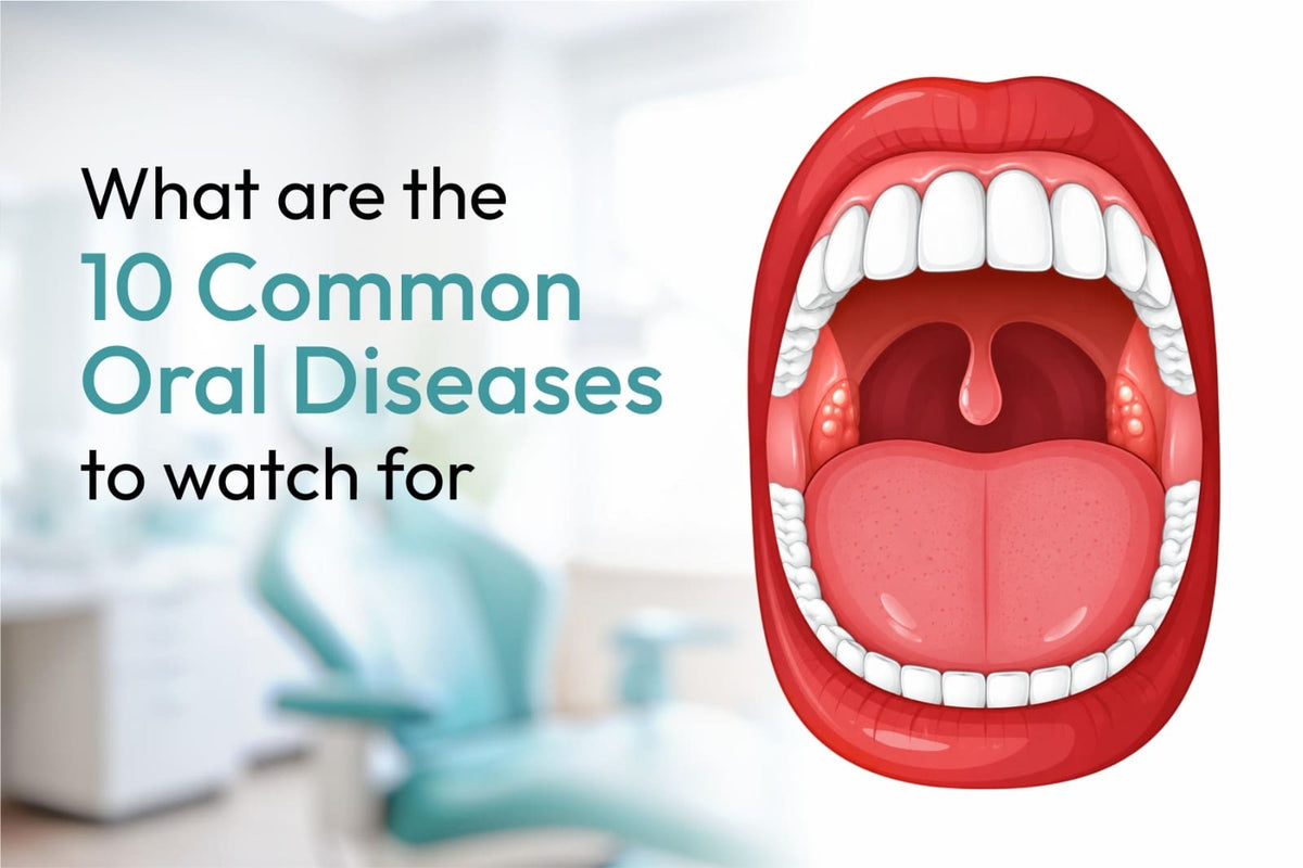 What Are the 10 Common Oral Diseases to Watch For