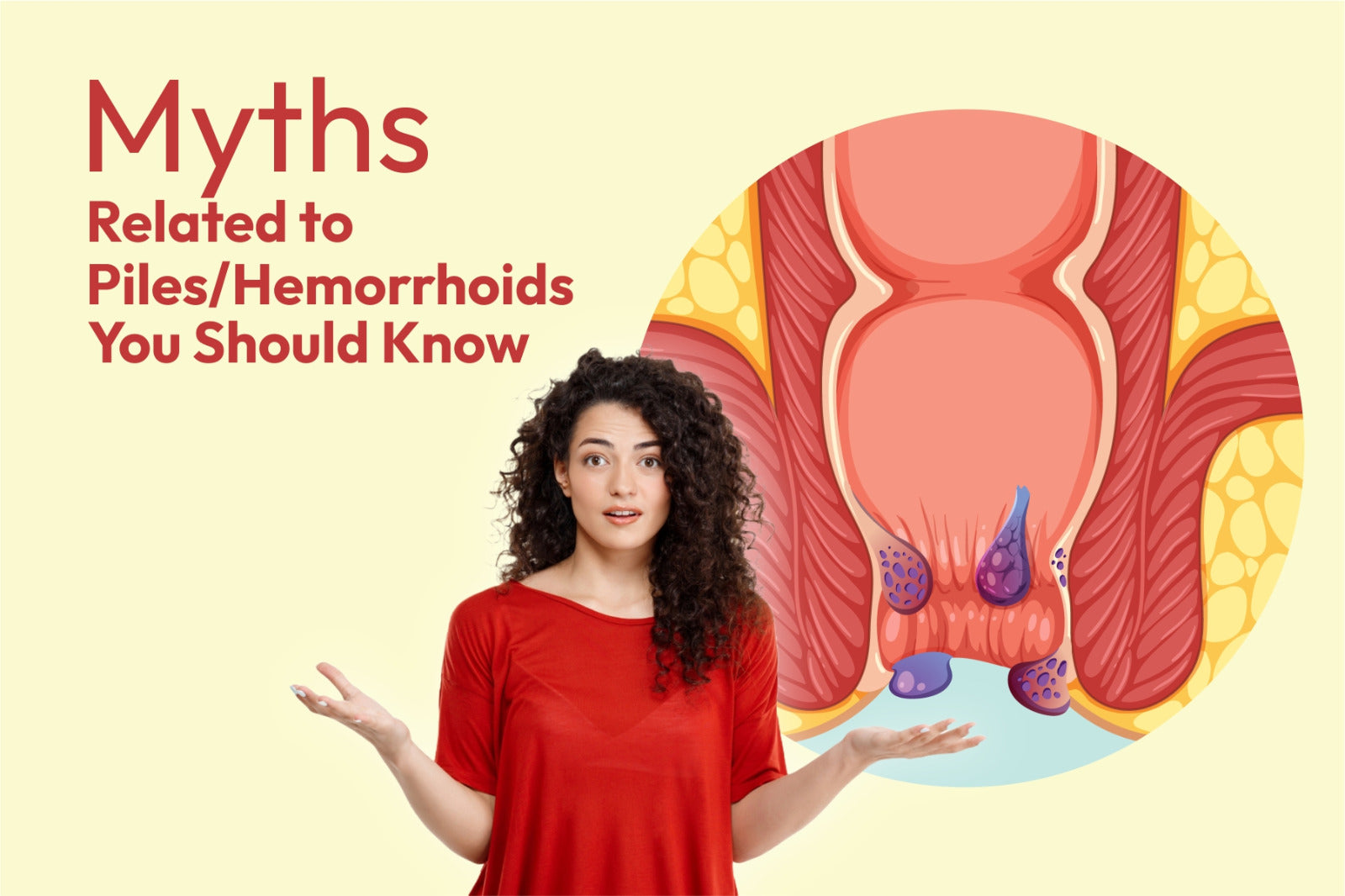 Myths Related to Piles/Hemorrhoids You Should Know