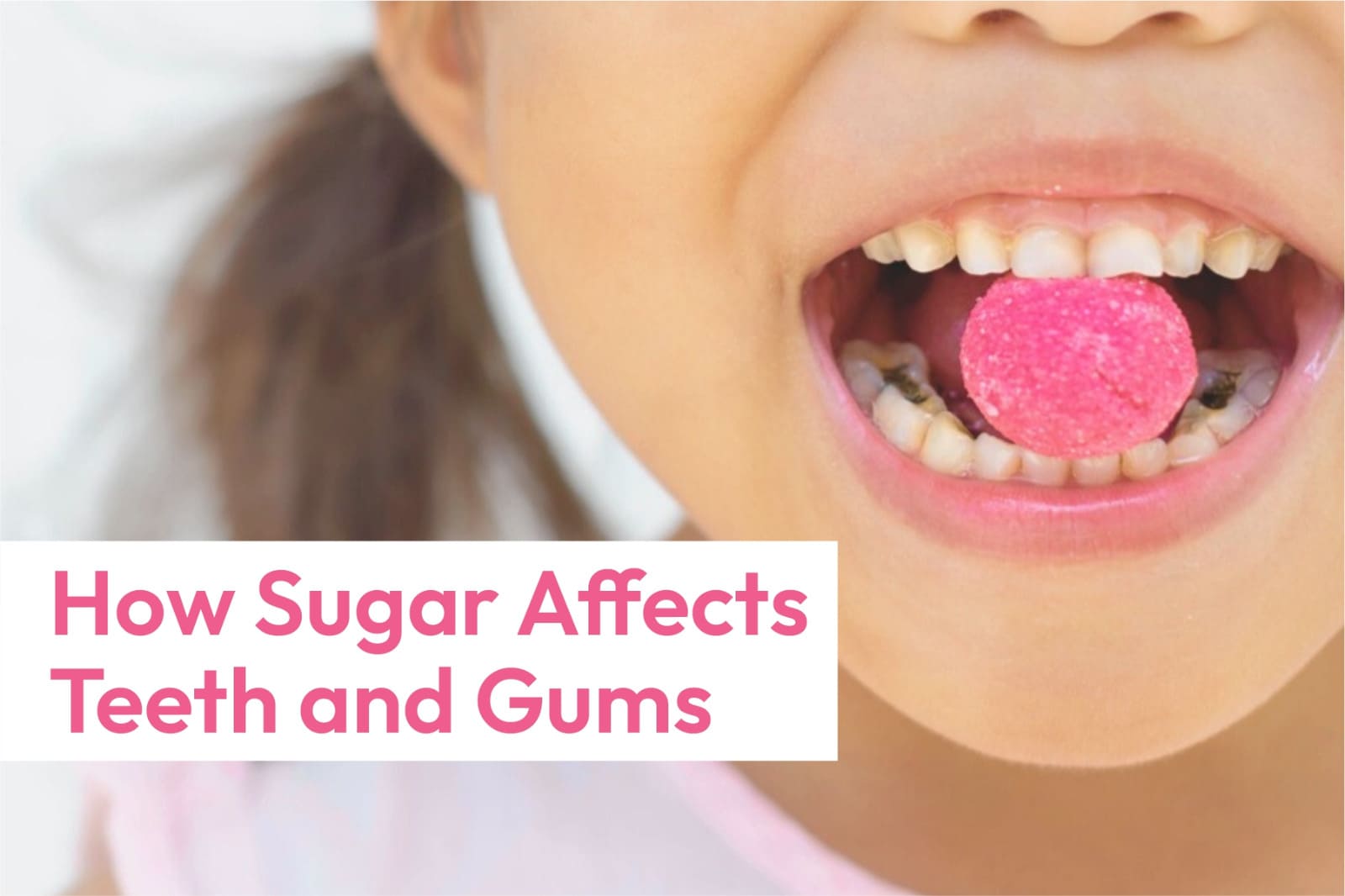 How Sugar Affects Teeth and Gums