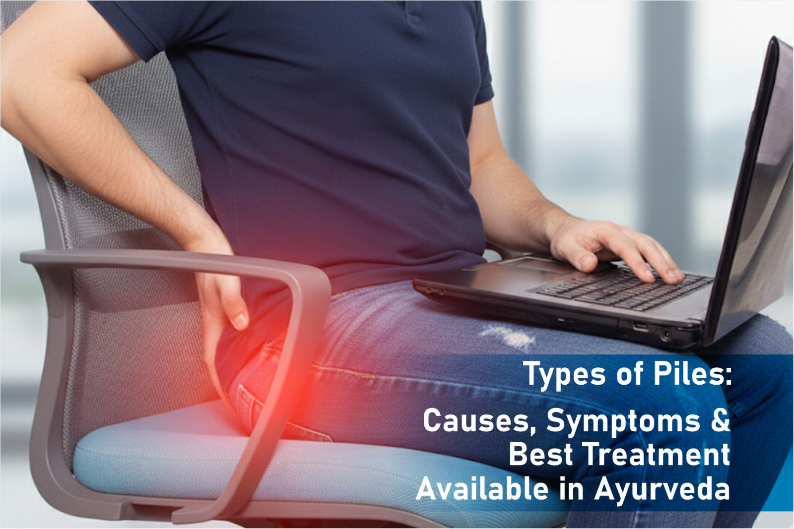 Types of Piles: Causes, Symptoms & Best Treatment Available in Ayurveda